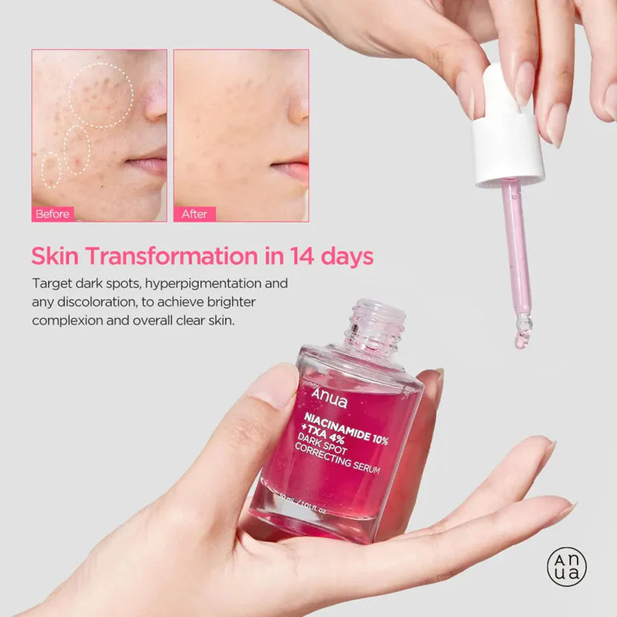 Anua brightening serum with TXA and niacinamide bottle with dropper held above hand showing before and after skin transformation