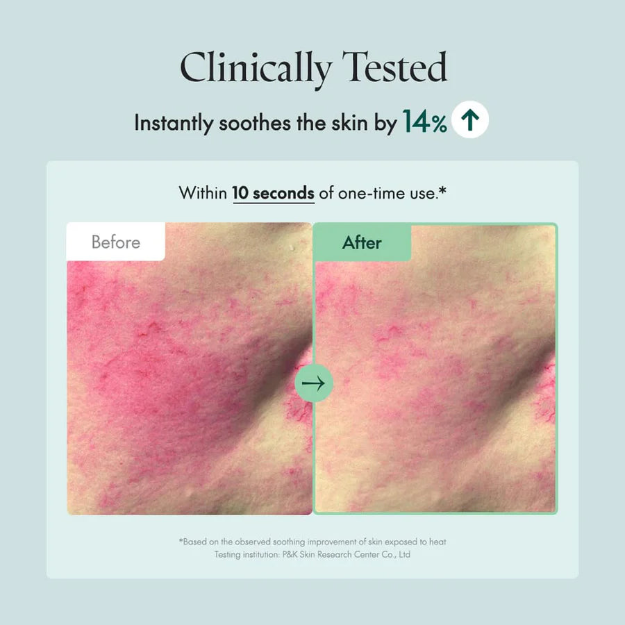 Before and after images showing skin redness reduction using Centella cream for sensitive skin by PURITO