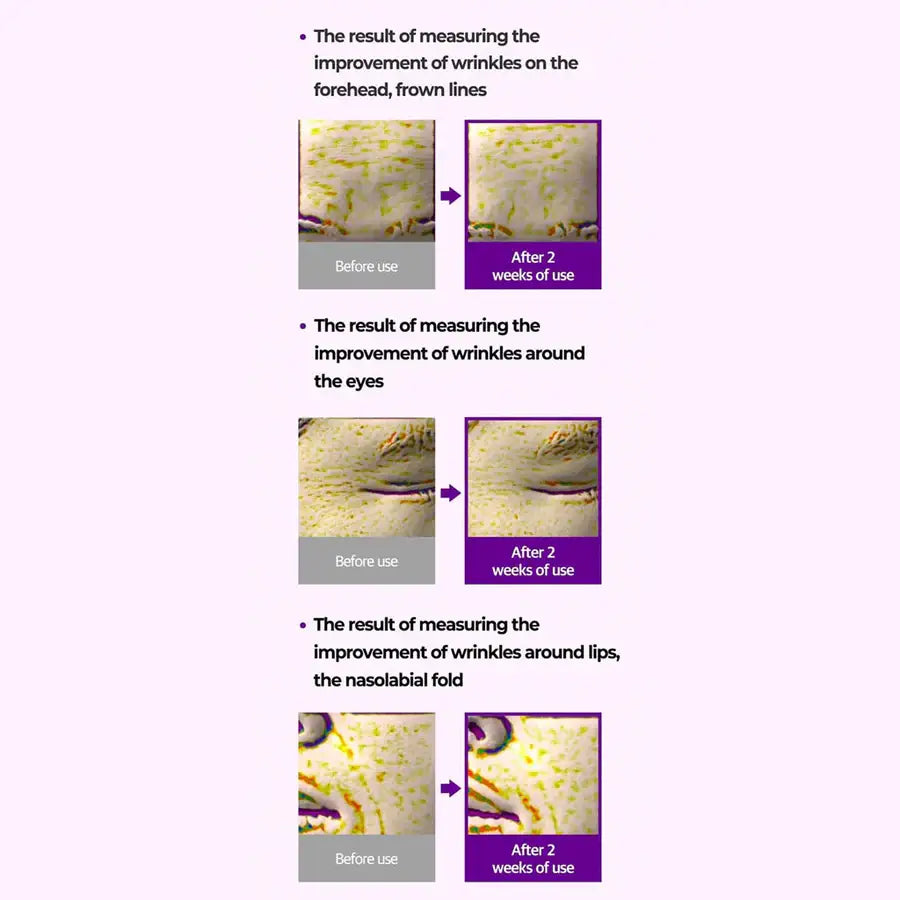 Before and after images showing wrinkle improvement after 2 weeks of using retinol eye cream for dark circles