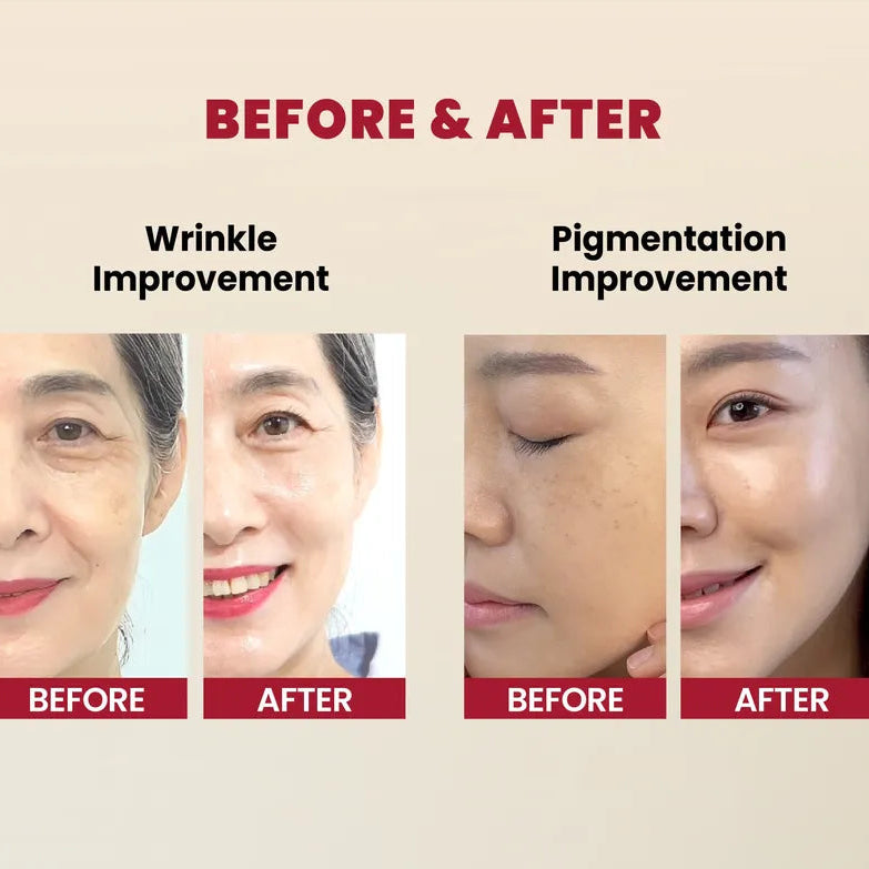 Before and after results showcasing Zuzu Aura retinal serum with black ginseng for wrinkle and pigmentation improvement